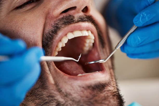 Best Emergency Dental Care for Broken or Chipped Teeth in Rittman, OH